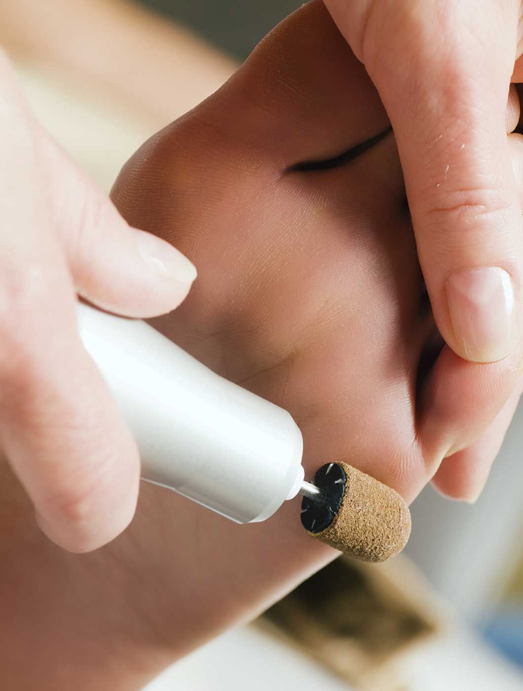 Studio di podologia Voghera, terapie riabilitazioni per i piedi e unghie e le nostre terapie trattate.